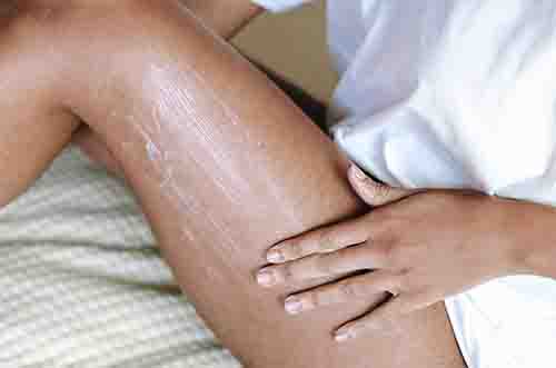 Palmer's Stretch Mark Class Action Settlement